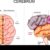 What is Frontotemporal Dementia? A Deep Dive