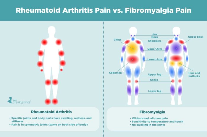 Rheumatoid arthritis flare up