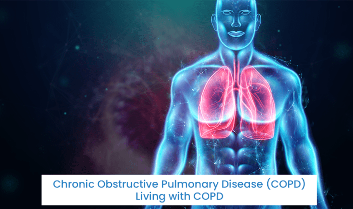 COPD Mucus Why the Increase?