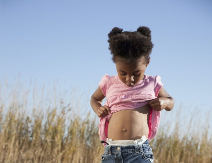 Belly button yeast infection