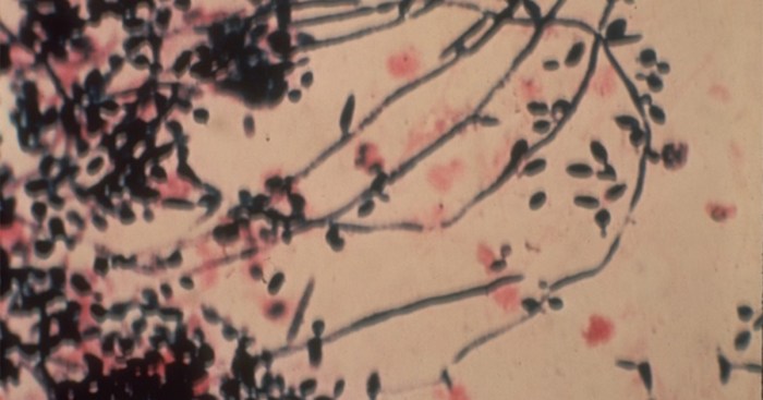 Pustular rash types treatment