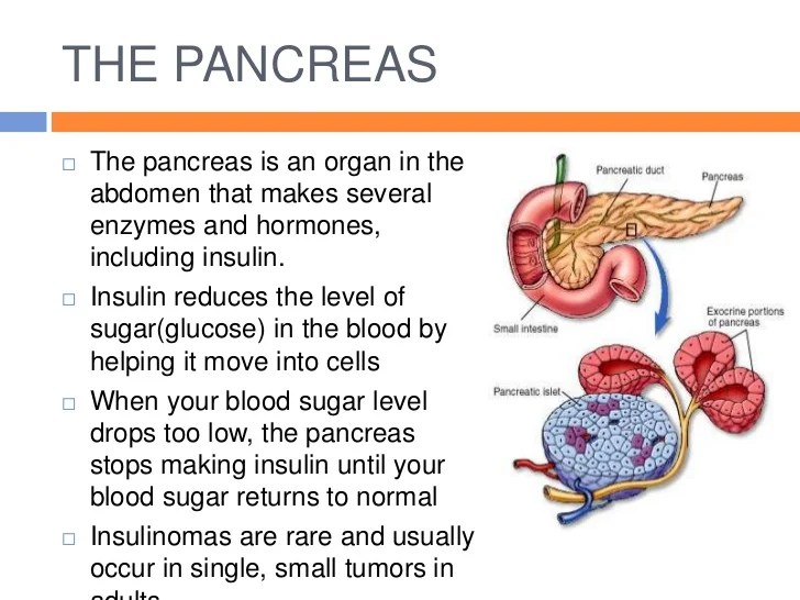 Insulinoma overview and more