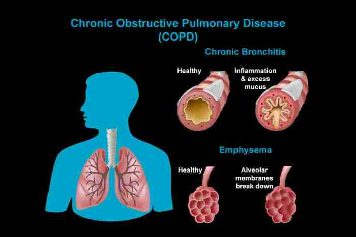 Why does copd cause increased mucus production