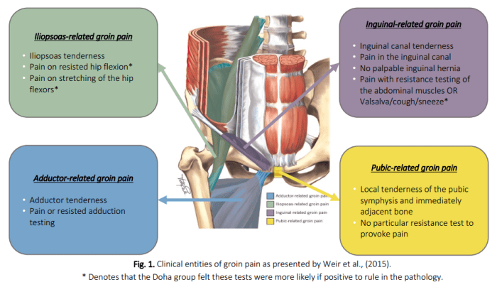 Groin pain when walking