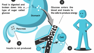 Glucose levels what you should know