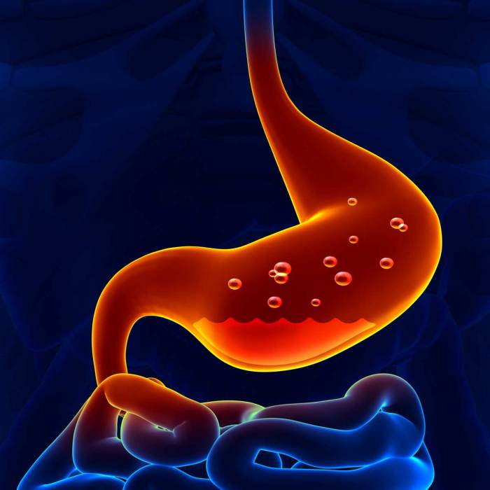 Sleep with stomach ulcer