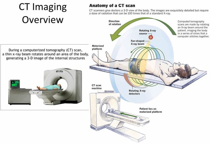 Ct lung cancer screening