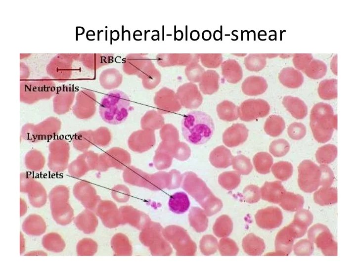 1 human blood, smear