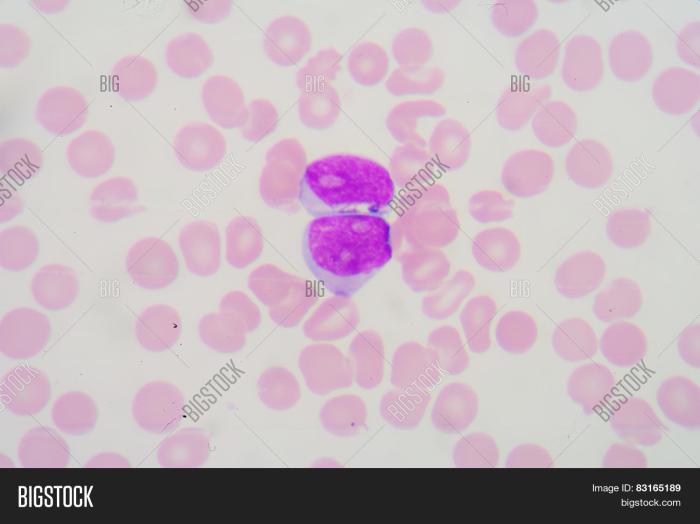 Blood smear uses and results