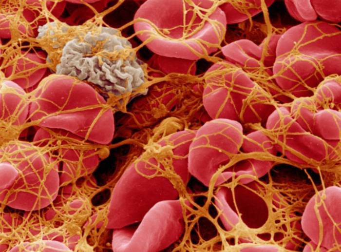 What are platelet function disorders